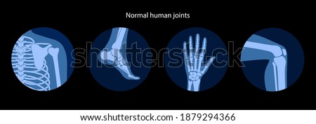 Set with human shoulder, knee, ankle and wrist icons. Normal joints and bones anatomy. Skeleton medical poster. Orthopedic or chiropractic treatment. Anatomical logo concept. Flat vector illustration. Royalty-Free Stock Photo #1879294366