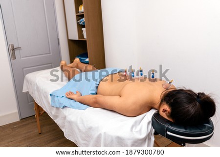 Stock photo of unrecognized woman lying on stretcher while receiving cupping treatment on her back.