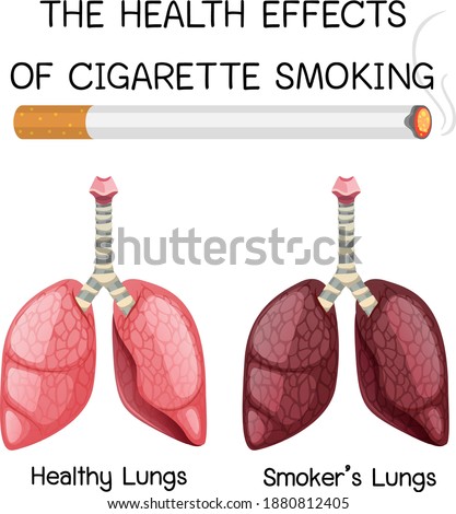 Poster on health effects of cigarette smoking illustration