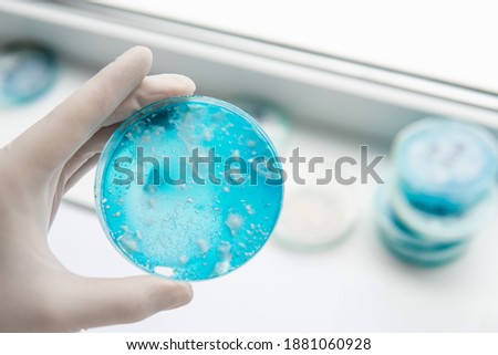 Fungal mycelium petri dish. Mycology Growing in a Petri dishes. Laboratory accessories.