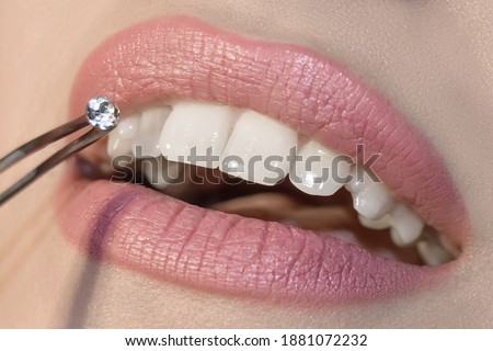 Dentist doctor select a gem or rhinestone for the patient’s teeth, Mouth close up Royalty-Free Stock Photo #1881072232