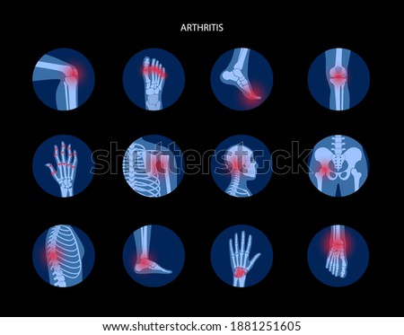 Set with spine, knee, wrist and other joint icons for clinic. Pain in the human body, anatomical logo concept. Arthritis, inflammation, bone disease medical poster or banner. Flat vector illustration. Royalty-Free Stock Photo #1881251605