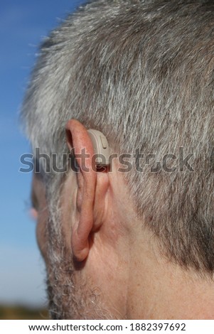 cochlear implant close up, therapy, hearing