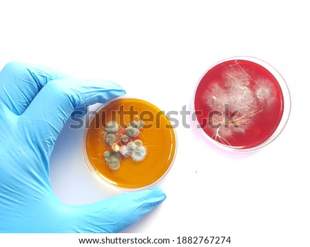 A dermatophyte test medium (DTM) culture in Petri dish using for growth media to isolate and cultivate fungal testing from clinical samples, investigation of ring worm (skin disease). Royalty-Free Stock Photo #1882767274