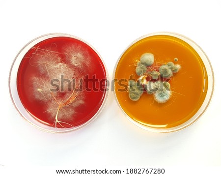 A dermatophyte test medium (DTM) culture in Petri dish using for growth media to isolate and cultivate fungal testing from clinical samples, investigation of ring worm (skin disease). Royalty-Free Stock Photo #1882767280