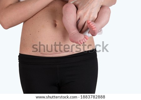 Woman's belly with a scar from a caesarean section. Woman with a baby in her arms close-up. Royalty-Free Stock Photo #1883782888
