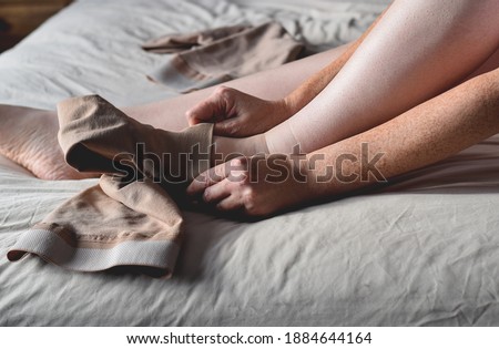 Woman putting on compression stockings on legs affected by lymphedema condition