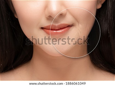 Comparison. Asian woman with problem and clean skin. beauty concept skin aging. anti-aging procedures, rejuvenation, lifting, tightening of facial skin, restoration of youthful skin anti-wrinkle Royalty-Free Stock Photo #1886061049