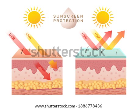 Uv skin protection. Damaged human skin peels before and after sun protection body adipose layers epidermis recent vector infographic template Royalty-Free Stock Photo #1886778436