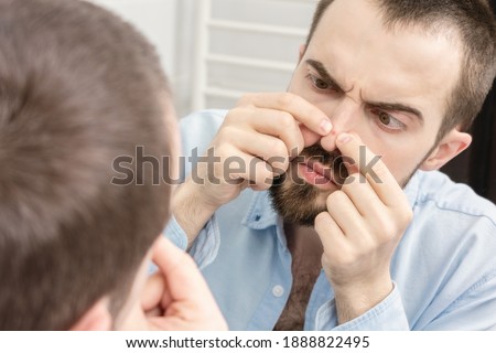 Funny man squeezes out a pimple on his nose, man looks at himself in the bathroom mirror, portrait, close-up Royalty-Free Stock Photo #1888822495