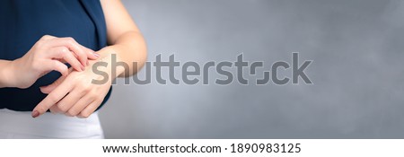 Banner close up of beautiful woman's hands with scar wound from heat burn. Healing, Removal, treatment, Hot oil burn, Vitamin E, Scars care, Skin care products, Medical cream, Advertising, Commercial. Royalty-Free Stock Photo #1890983125