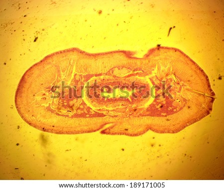 Earthworm (Lumbricus sp.) transverse slit - permanent slide plate under high magnification