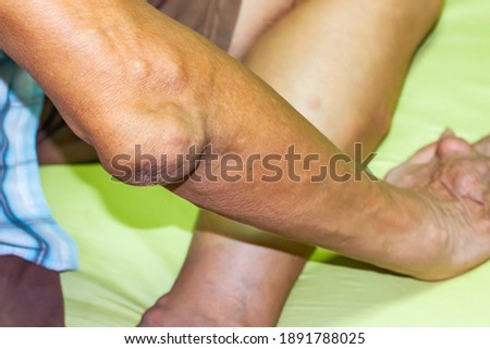 Old age and illnesses of pharmaceutical medicament severe gout in men suffering from joint pain, bone pain, gout ,arthritis ,arm, foot, knee, rheumatoid symptoms, Concept of abstract pain and despair