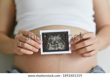 Close up Pregnant woman holding ultrasound scan photo on her belly. Mother with sonogram of her unborn baby. Concept of pregnancy, Maternity prenatal care