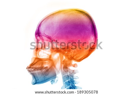 colorful skull human x-rays image