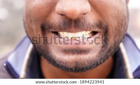 Beautiful wide smile of young fresh boy with great healthy white teeth