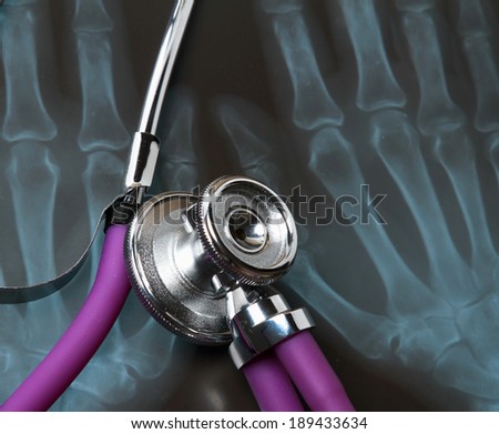 A medical stethoscope on an x-ray picture, closeup