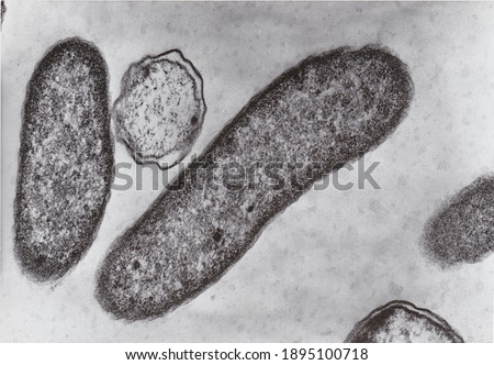Transmission electron microscope photo of vibrio bacteria x76000 Royalty-Free Stock Photo #1895100718