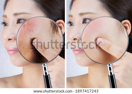The texture of the skin of young women is magnified and compared with a magnifying glass. Royalty-Free Stock Photo #1897417243