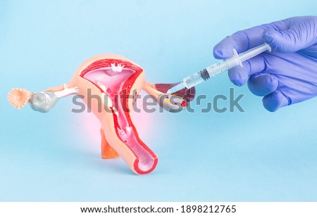 Doctor plastic surgeon with a syringe on the background of a model of female genital organs. The concept of intimate plastic surgery for a girl, aesthetic Royalty-Free Stock Photo #1898212765