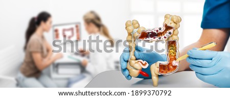 Treatment cancer colon. Doctor pointing pen tumor intestines using an anatomical model. Consultation gastroenterologist for a patient over background Royalty-Free Stock Photo #1899370792