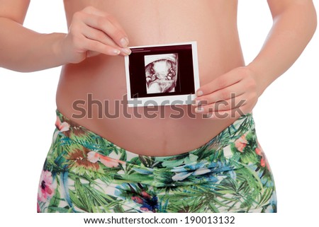 Excited pregnant woman with a ultrasound of her baby woman isolated on white background