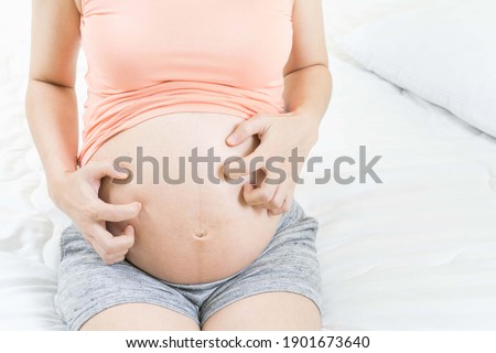 Pregnant woman scratching belly because itchy skin which causes striped- Pregnancy medicine concept. Royalty-Free Stock Photo #1901673640