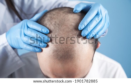 Doctor hands on patient head. Hair growth Royalty-Free Stock Photo #1901782885