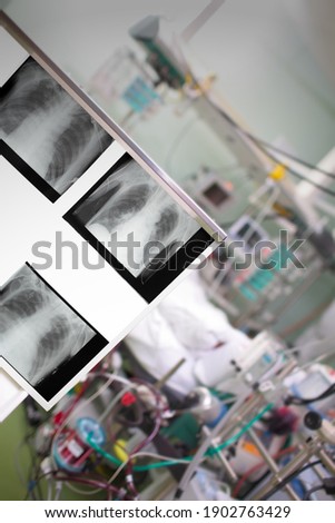 X-ray images on the background of patinet in the ICU.