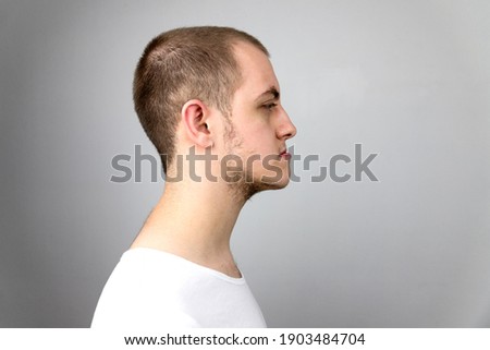 Malocclusion, man in profile. Wrong bite: lower jaw extended forward and retracted. Bite correction with braces. Young man in profile Royalty-Free Stock Photo #1903484704