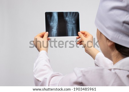 A doctor or radiologist holds an X-ray of a patient with a hand injury. Diagnosis of fractures, fractures of bones and dislocations of the joints of the arm