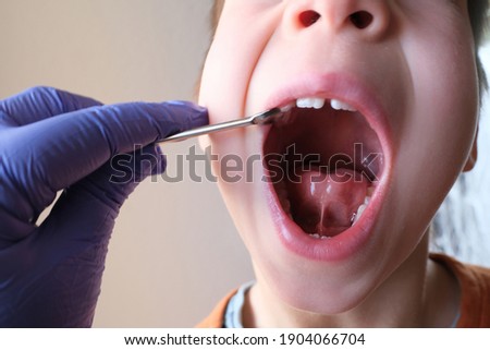 dentist, doctor examines oral cavity of small patient, length of frenum, boy, kid performs articulation exercises for mouth, concept of speech disorders, correction, selective focus on bridle of tongu Royalty-Free Stock Photo #1904066704