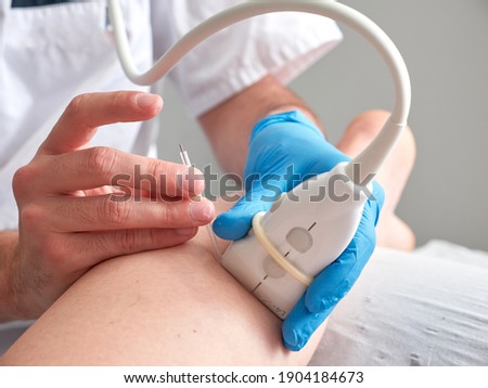 Doctor or physiotherapist treating a patient with percutaneous electrolysis, no faces shown Royalty-Free Stock Photo #1904184673