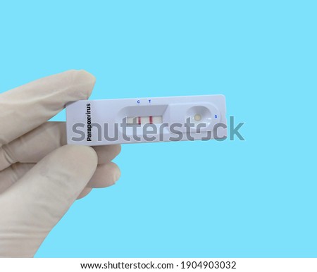 Biochemist or Lab Technologist holds a Device of Parapoxvirus rapid screening test. Device Test showing positive result in the laboratory background. 