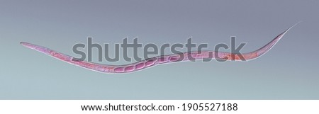 Nematode roundworm stained under the phase contrast microscope Royalty-Free Stock Photo #1905527188
