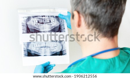 The dentist examines a panoramic X-ray image of the teeth of the upper and lower jaws. Preparation for dental implantation. The visceral surgeon makes a diagnosis before the bone augmentation surgery. Royalty-Free Stock Photo #1906212556
