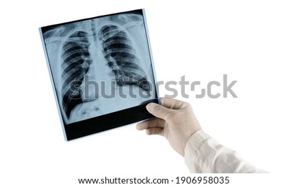 X-ray of human lungs at doctor's hand isolated on white background, medical worker examines lung disease. Royalty-Free Stock Photo #1906958035