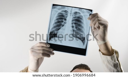 X-ray picture of a man in the hands of a doctor, a medical worker examines an X-ray of the lungs. Pneumonia. 