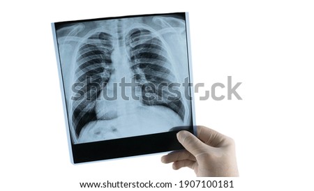 Human lung x-ray analysis, doctor examines lung disease. Pneumonia. Lung x-ray isolated on white background.