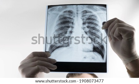 The doctor is looking at the X-ray of the lungs in the clinic, the medical worker is analyzing the disease of pneumonia of the lungs. Respiratory disease. Royalty-Free Stock Photo #1908073477