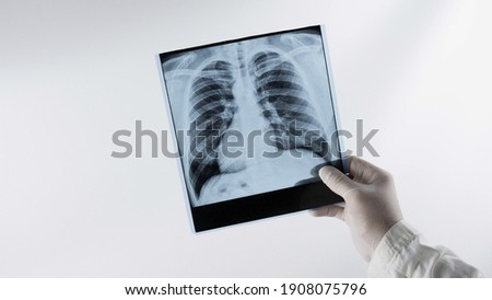 X-ray of human lungs on a white background at a doctor in the hands of an X-ray lung, a medical worker analyzes the disease of pneumonia, respiratory disease. Royalty-Free Stock Photo #1908075796