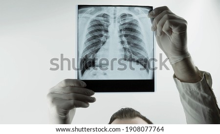 A doctor at the clinic examines an x-ray of the lungs, pneumonia with a complication on an x-ray, the doctor looks at an x-ray of the lungs, a respiratory disease. Royalty-Free Stock Photo #1908077764