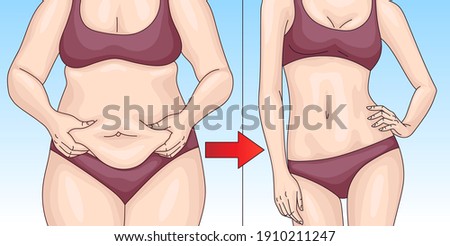 Before and after losing weight. Fat and slender woman in red underwear on a blue background. Weight loss concept.	 Royalty-Free Stock Photo #1910211247