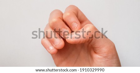 boys hand with chewed fingernails on white background - kids hand with short fingernails Royalty-Free Stock Photo #1910329990