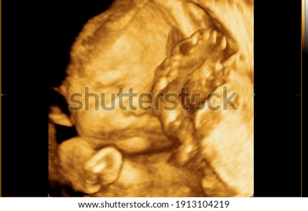 Colourful image of pregnancy ultrasound monitor