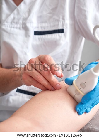 physio therapist treating a patient with percutaneous electrolysis, no faces shown Royalty-Free Stock Photo #1913112646