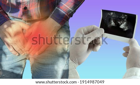 The male prostate gland is examined by an ultrasound scan at the doctor's hands, the prostate adenoma is analyzed by a urologist, a person with pain in the genitourinary system. Royalty-Free Stock Photo #1914987049