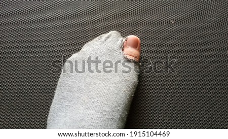 Broken left side sock with a hole in a thumb