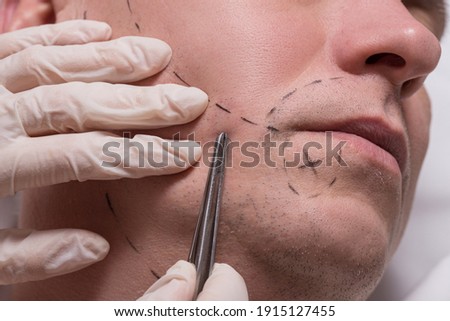 Man beauty procedure beard hair implant for senior man Royalty-Free Stock Photo #1915127455