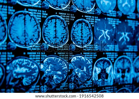 MRI scan of the brain. Magnetic resonance imaging scan Royalty-Free Stock Photo #1916542508